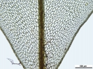 Rhizomnium appalachianum