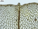 Rhizomnium appalachianum