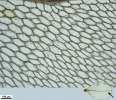 Rhizomnium appalachianum