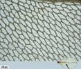 Rhizomnium appalachianum