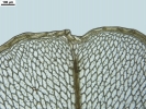 Rhizomnium appalachianum