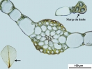 Rhizomnium appalachianum