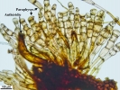 Rhizomnium appalachianum
