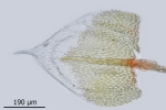 Bryum argenteum