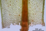 Bryum canariense