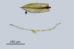 Bryum canariense