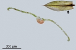 Bryum canariense