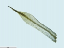 Pogonatum dentatum