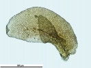 Frullania asagrayana