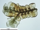 Frullania asagrayana