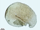 Frullania asagrayana