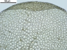 Frullania asagrayana