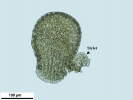 Frullania asagrayana