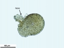 Frullania asagrayana