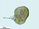 Frullania asagrayana