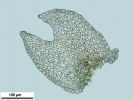 Frullania asagrayana