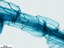 Sphagnum meridense
