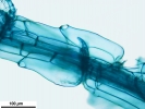 Sphagnum meridense