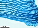 Sphagnum meridense