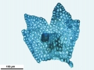 Frullania dilatata