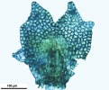 Frullania dilatata