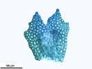Frullania dilatata