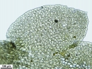Scapania calcicola