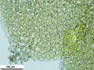 Scapania calcicola