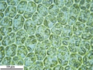 Scapania calcicola