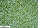 Scapania calcicola