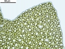 Mesoptychia gillmanii