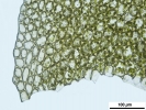 Mesoptychia gillmanii