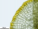 Lewinskya sordida
