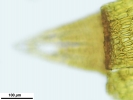 Lewinskya sordida