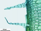 Lewinskya sordida