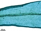Lewinskya sordida