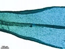 Lewinskya sordida