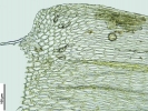 Brachythecium turgidum