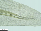 Brachythecium turgidum