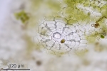 Reboulia hemisphaerica