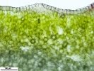 Mannia controversa