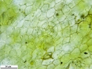 Mannia controversa