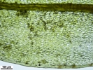 Ptychostomum donianum