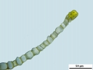 Ptychostomum donianum