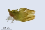 Cephaloziella baumgartneri