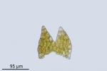 Cephaloziella baumgartneri