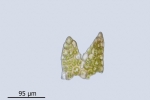 Cephaloziella baumgartneri