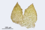 Cephaloziella baumgartneri