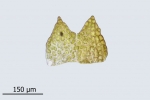 Cephaloziella baumgartneri