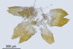 Cephaloziella baumgartneri